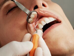 Dentist malpractice