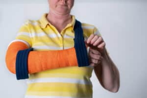 Broken arm; personal injury; best personal injury lawyer in Cincinnati